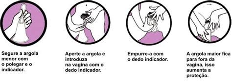 camisinha feminina|Como Colocar a Camisinha (com Imagens)